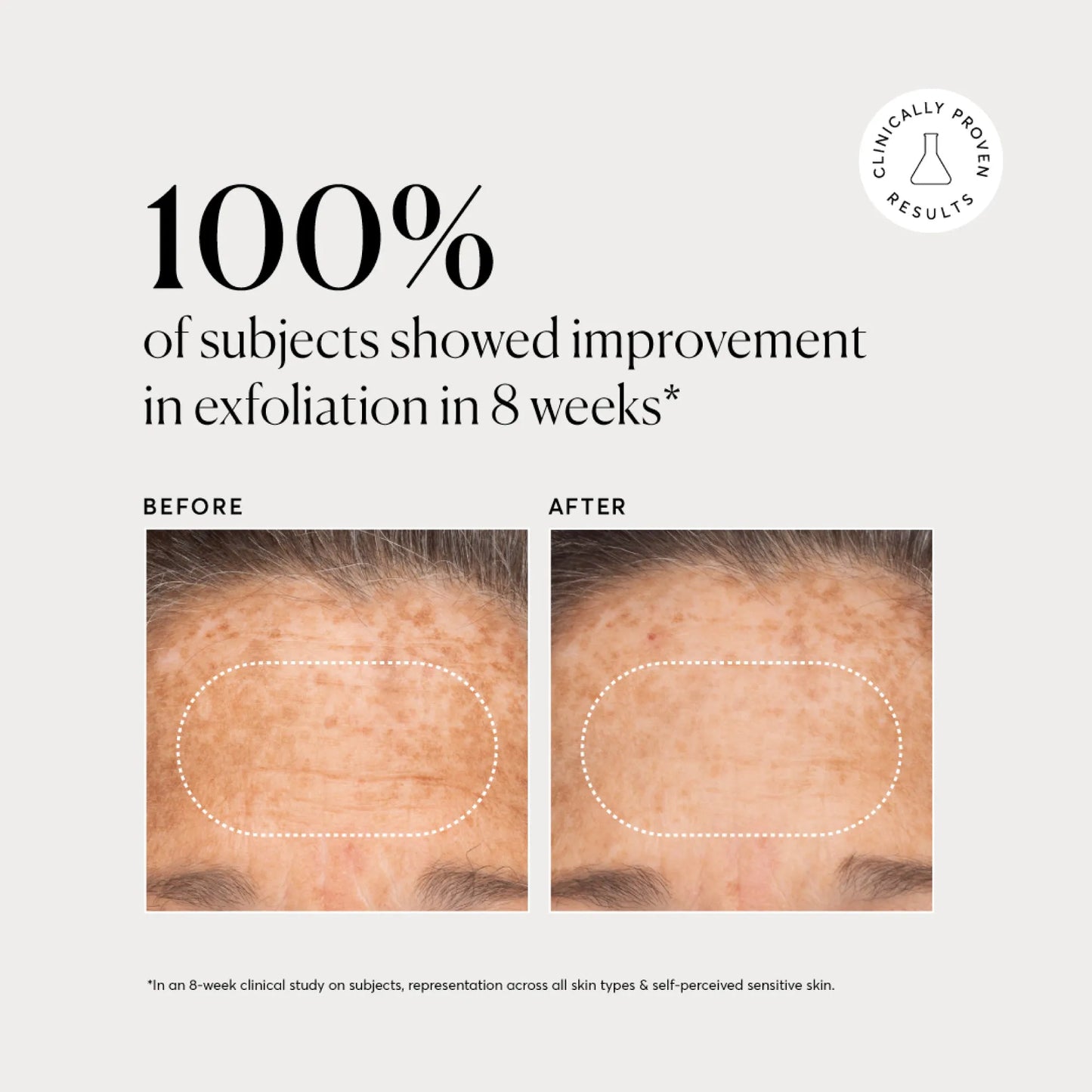 bha-liquid-exfoliant-2-d5 NATR-10027-Alt-Images-BHA-Liquid-Exfoliant-2_-03.webp